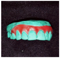 dentistry-case-Wax