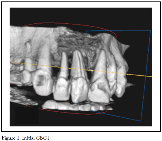 dentistry-cbct