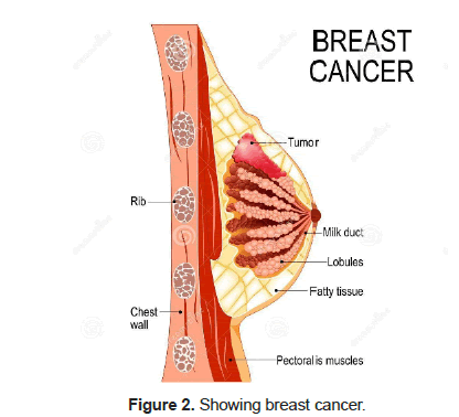 health-sciences-cancer