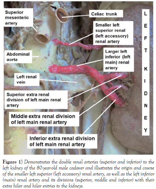 international-journal-anatomical-variations-Demonstrates
