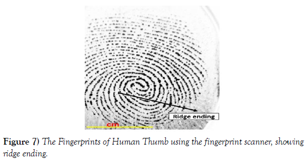 international-journal-anatomical-variations-Human