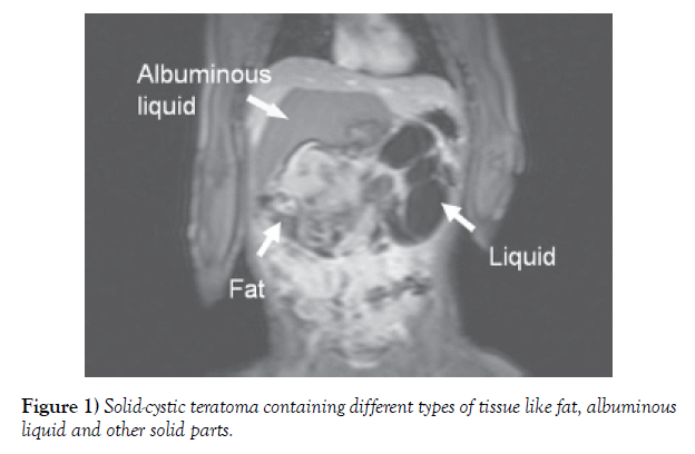 international-journal-anatomical-variations-containing