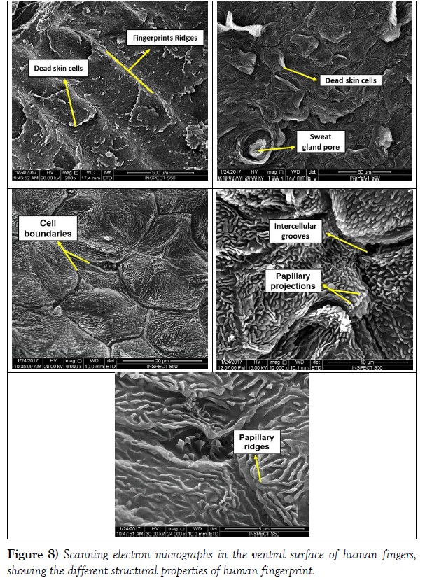 international-journal-anatomical-variations-electron