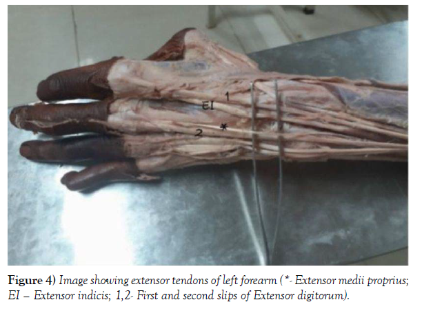 international-journal-anatomical-variations-forearm