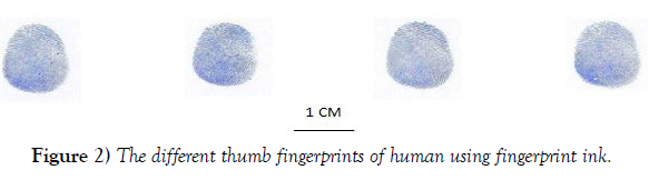 international-journal-anatomical-variations-human