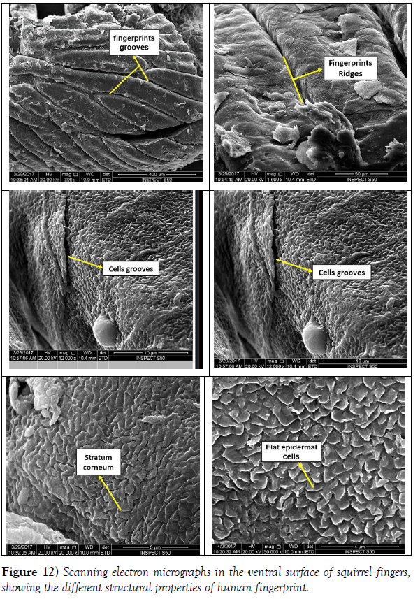 international-journal-anatomical-variations-micrographs