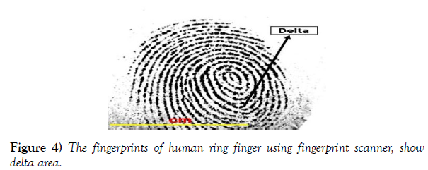 international-journal-anatomical-variations-scanner