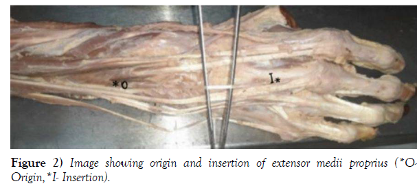 international-journal-anatomical-variations-showing