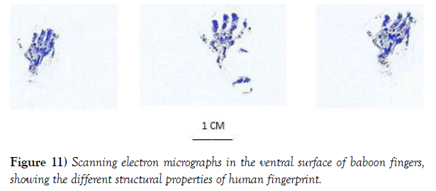 international-journal-anatomical-variations-surface