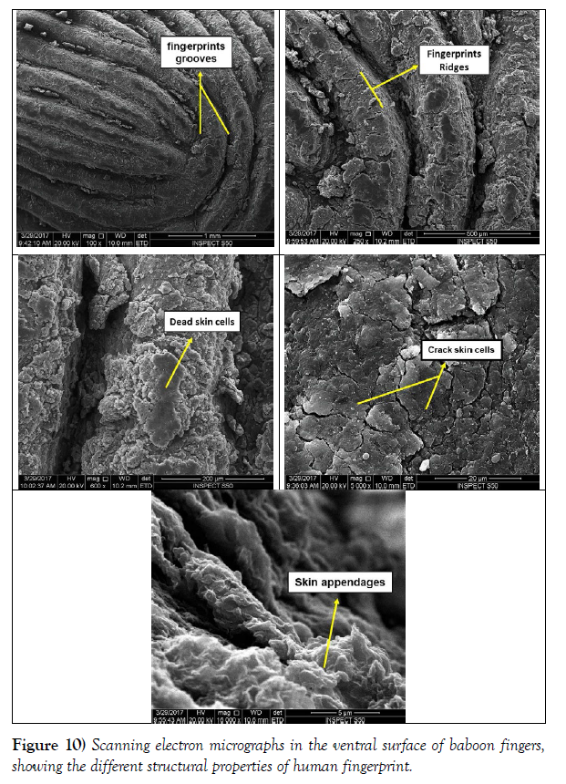 international-journal-anatomical-variations-ventral