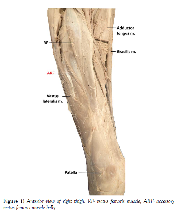 international-journal-anterior