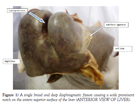 international-journal-diaphragmatic