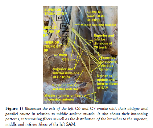 international-journal-exit