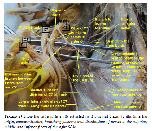 international-journal-laterally