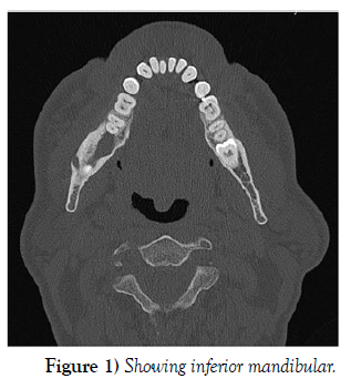 international-journal-showing