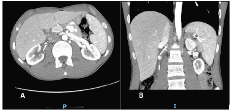 pulscr-angiography