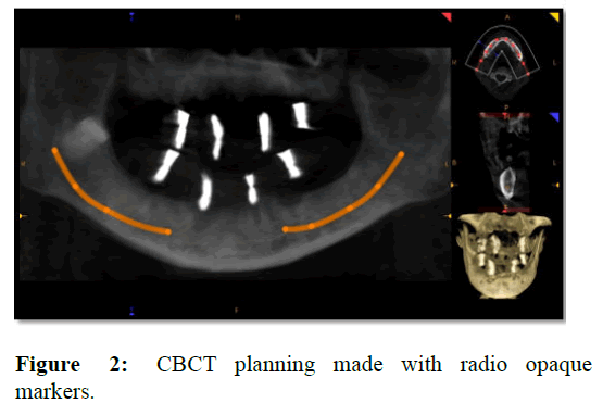 AMHSR-CBCT