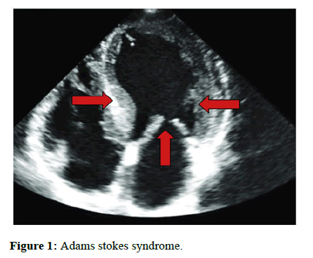 Annals-Research-Adams