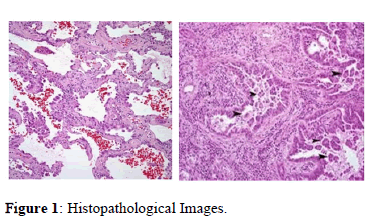 Annals-Research-Histopathological