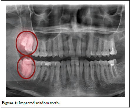 Biomedical-engineering-teeth