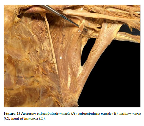 international-journal-anatomical-variations-Accessory