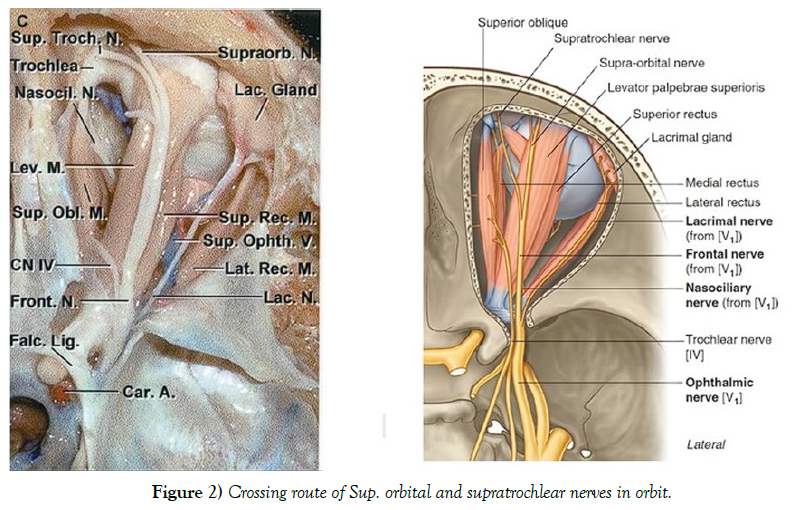 international-journal-anatomical-variations-Crossing