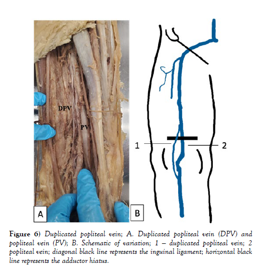 international-journal-anatomical-variations-Duplicated