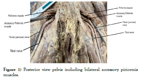 international-journal-anatomical-variations-Posterior