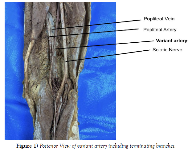 international-journal-anatomical-variations-Posterior