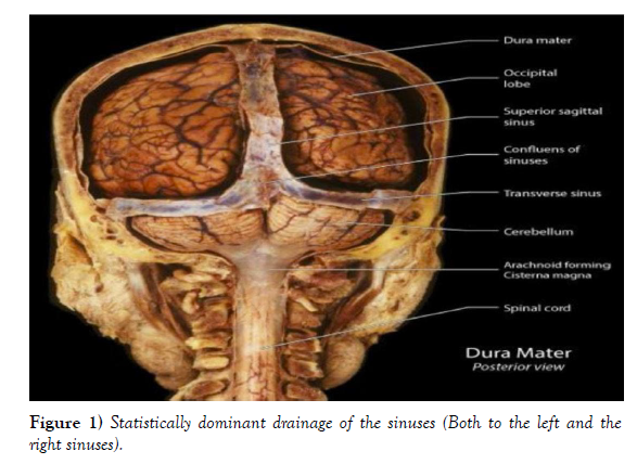 international-journal-anatomical-variations-Statistically