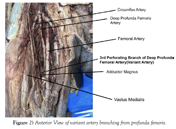 international-journal-anatomical-variations