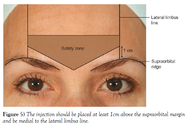 international-journal-anatomical-variations-injection