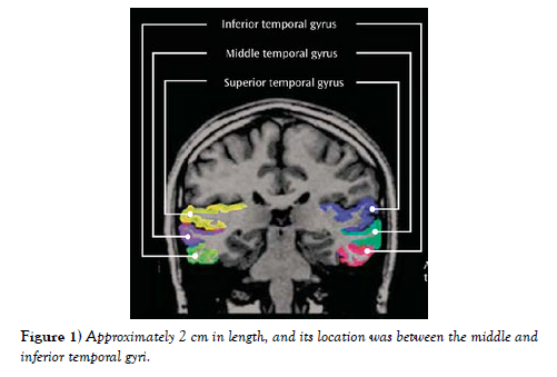 international-journal-anatomical-variations-length