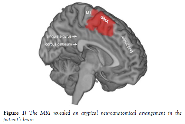 international-journal-anatomical-variations