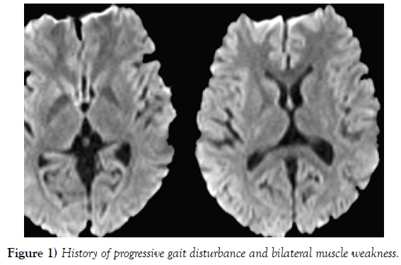 international-journal-anatomical-variations-progressive