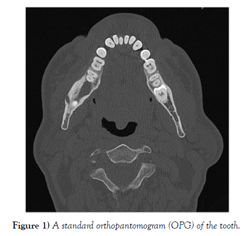 international-journal-anatomical-variations-standard