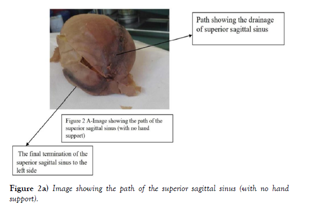 international-journal-anatomical-variations-support