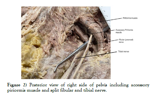 international-journal-anatomical-variations-view