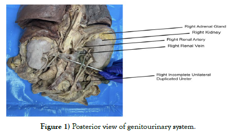 international-journal-anatomical-variations-view