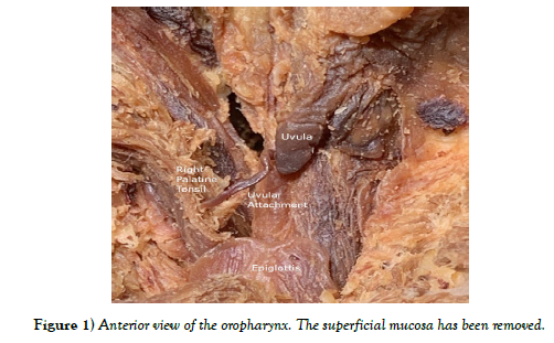 international-journal-anatomical-variations-view