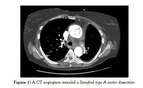 international-journal-angiogram