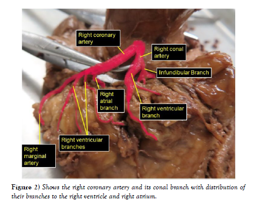 international-journal-coronary