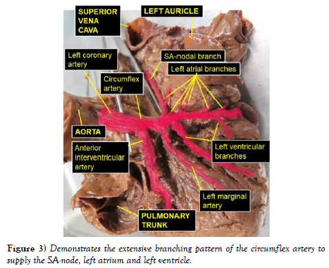 international-journal-extensive