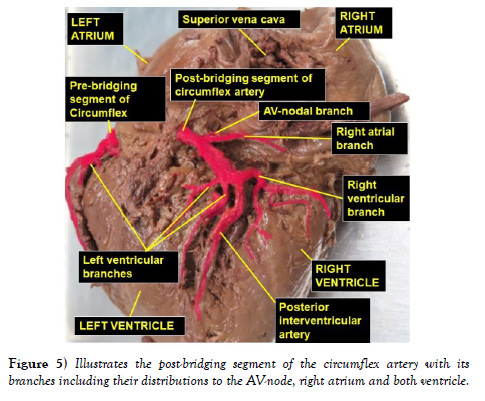 international-journal-segment