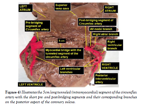 international-journal-tunneled