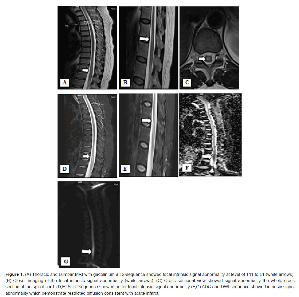 medical-health-tyre