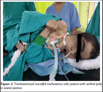 pulacr-lateral pulacr-lateral