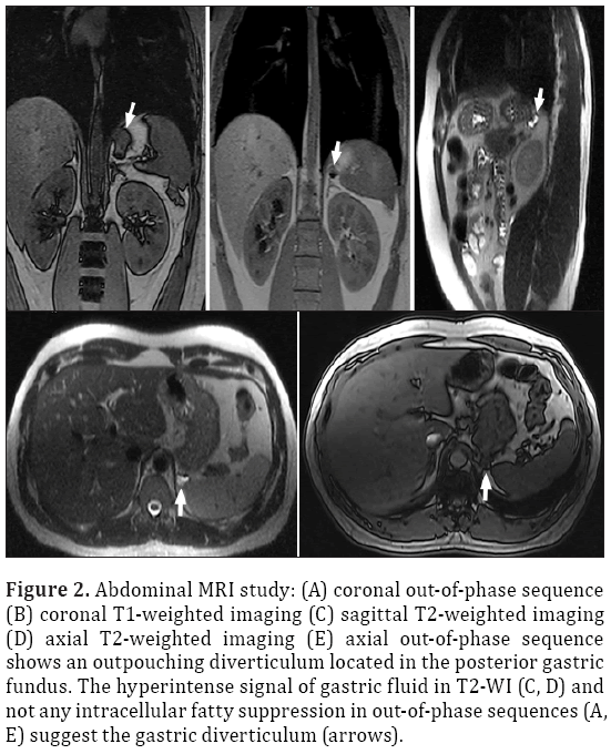 Anatomical-Variations-Abdominal-MRI-study