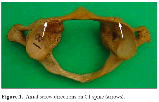 Anatomical-Variations-Axial-screw-directions