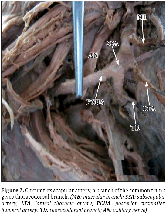 Anatomical-Variations-Circumflex-scapular-artery